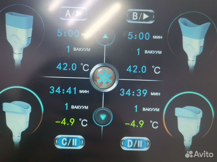 Криолиполиз