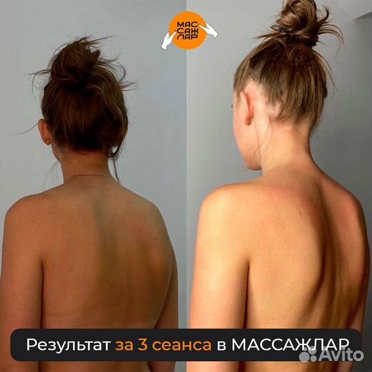 Массаж исправление осанки