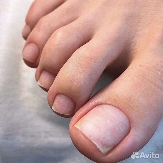 Педикюр,медицинский педикюр,Подолог.Ломоносовская