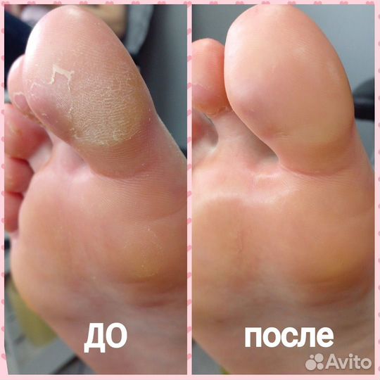 Маникюр, педикюр