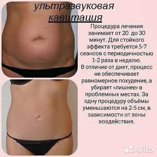 Мощный антицеллюлитный комплекс