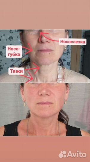 Миофасциальный + скульптурный массаж лица