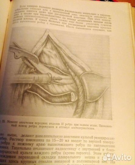 Местное обезболивание по методу