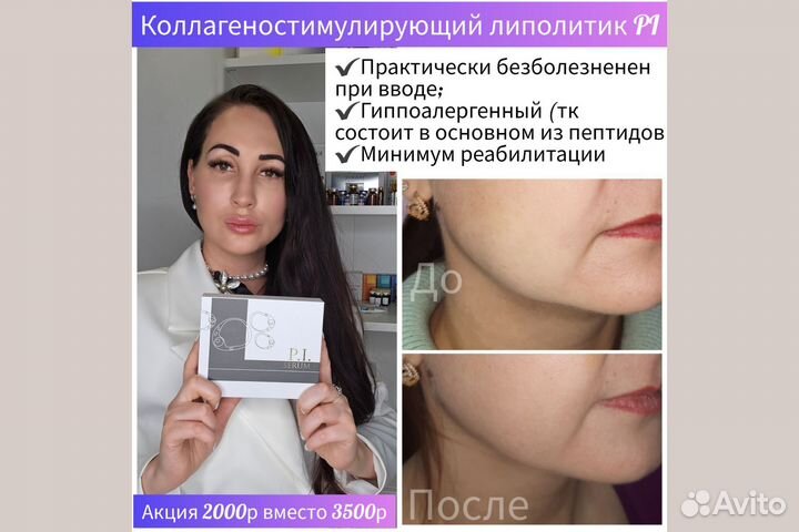 Косметолог уберу брыли