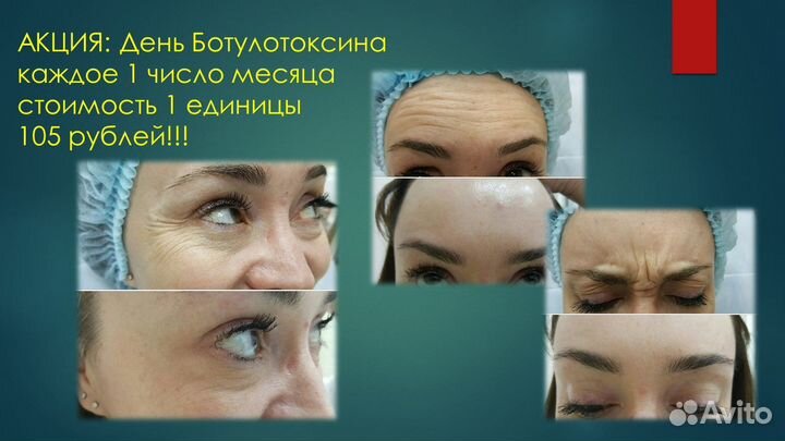 Услуги косметолога