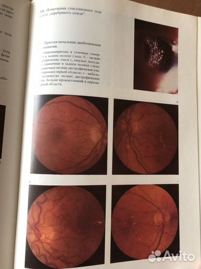 Атлас Глазных болезней