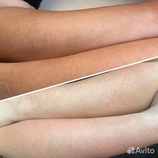 Мастер шугаринга