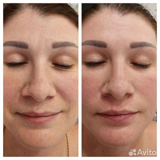 Массаж лица