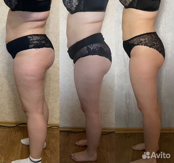 Массаж лица и тела