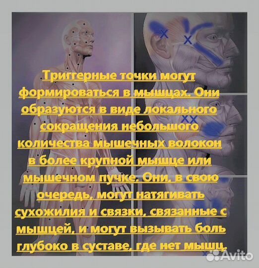 Миопрессура-Юмейхо-Йога