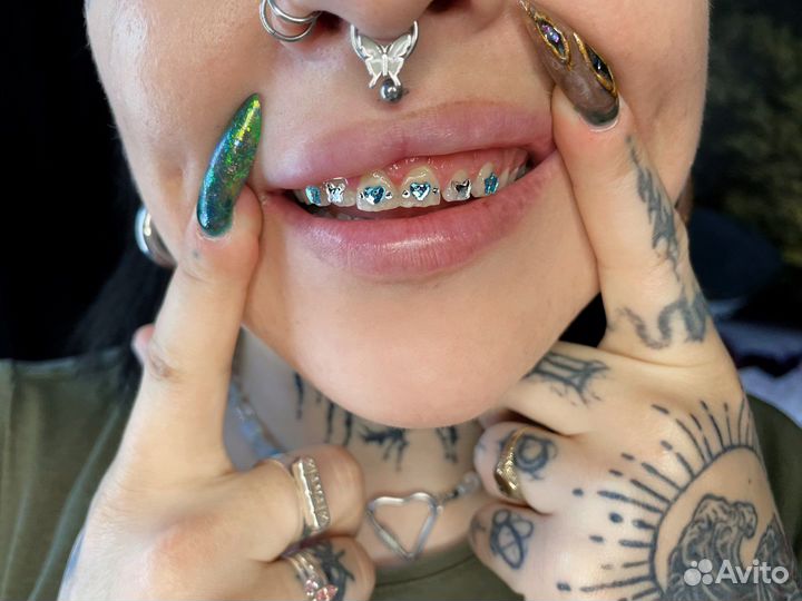 Установка скайсов (кристаллов/страз на зубы)