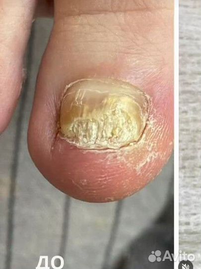 Услуги подолога