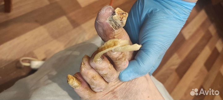 Педикюр с выездом для пожилых