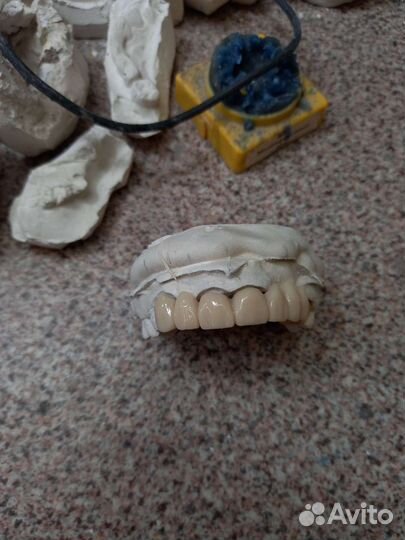 Работа зубной техник