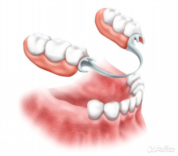 Зубные протезы