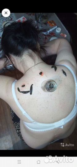 Пиявки медицинские