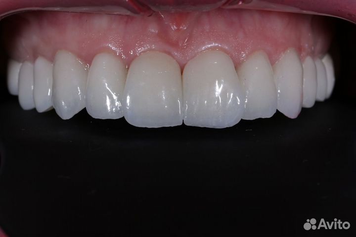 Зуботехническая лаборатория зубной техник