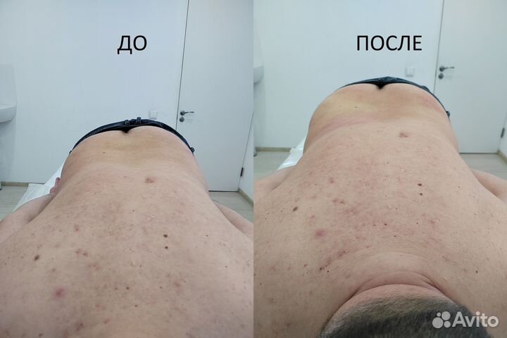 Костоправ Мануальный терапевт Краснодар