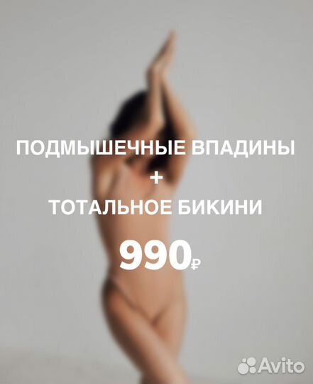 Лазерная эпиляция