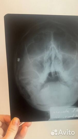 Рентгеновские снимки