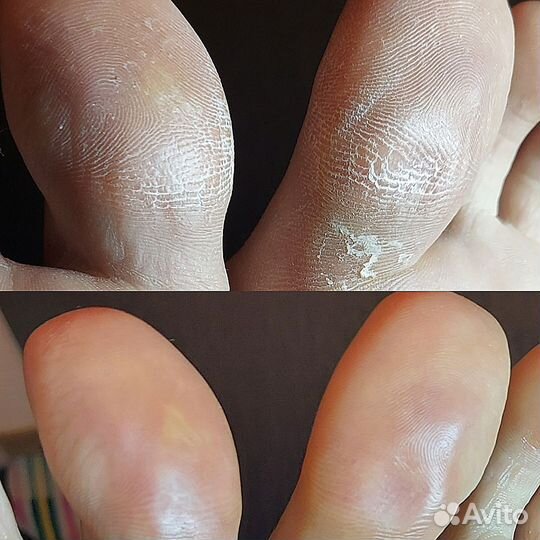 Модели на SMART педикюр