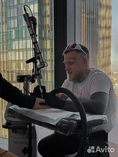 Лазерное удаление татуировок