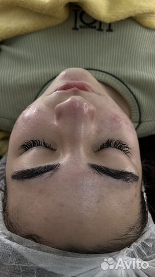 Косметолог чистка лица+пилинги