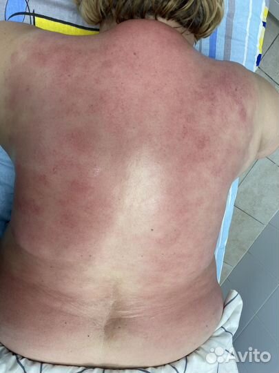 Горячий вакуумный массаж