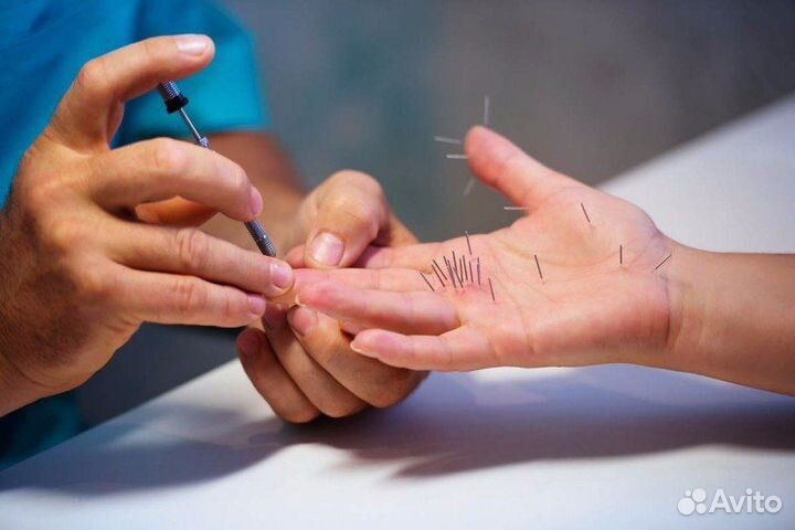 Су-Джок. Иглоукалывание. Здоровье. Массаж