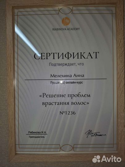 Депиляция