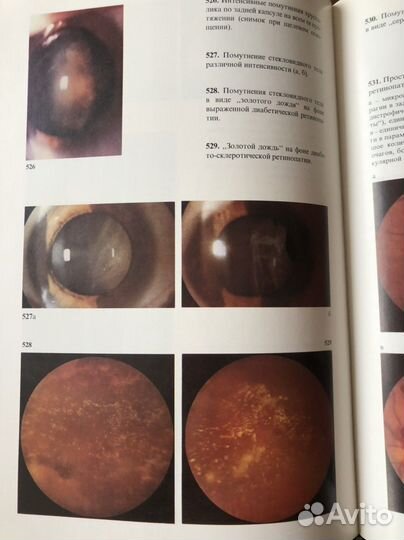 Атлас Глазных болезней