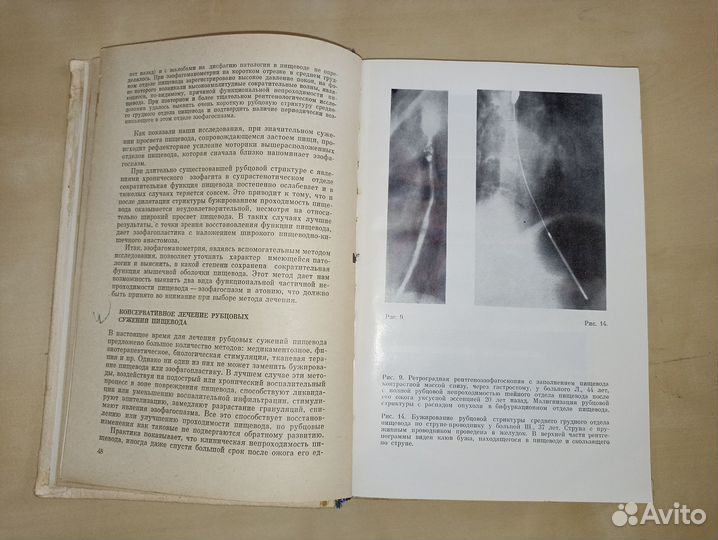 Лечение ожогов и рубцовых сужений пищевода. 1971