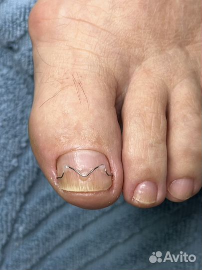 Услуги подолога