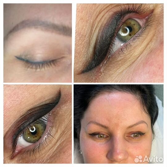 Татуаж, Карбоновый пилинг, Лазер, Косметология