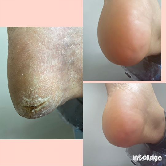 Маникюр, смарт педикюр, оформление бровей Мещера