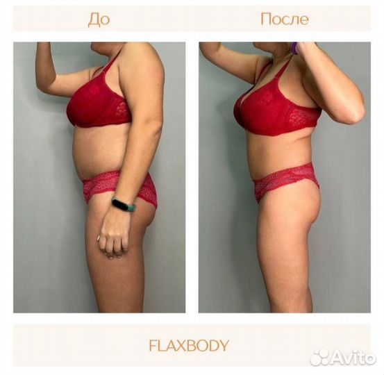 Аппаратная Коррекция фигуры