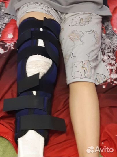 Бандаж на колено (тутор, ортез)