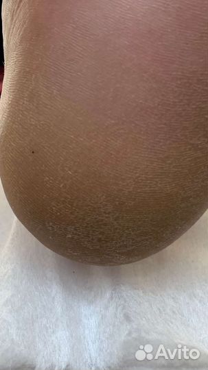 Модель на педикюр