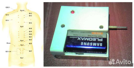 Акупунктурный стимулятор