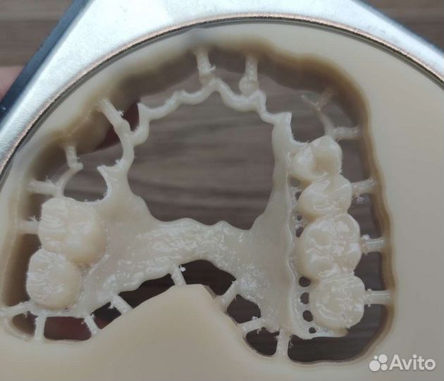 3d моделирование каркасов бюгельных протезов