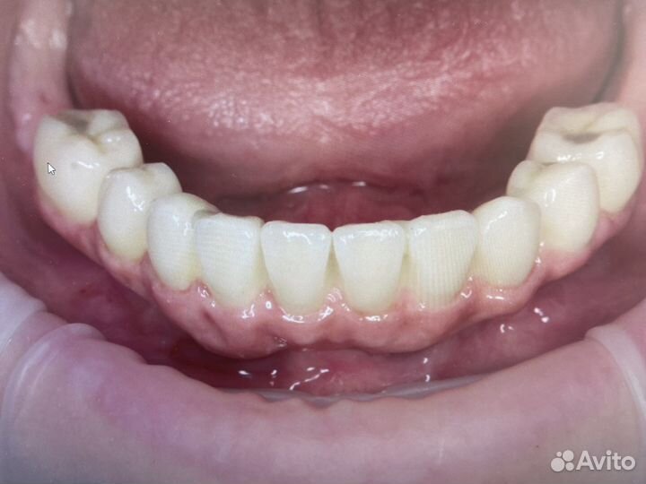 Все на 4х/all on 4