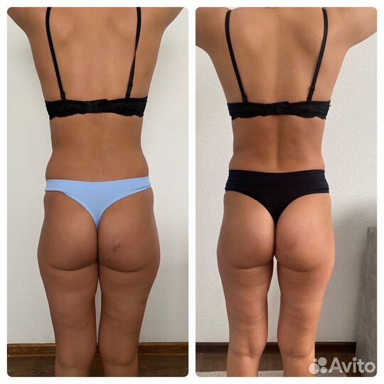 Массаж Кемерово