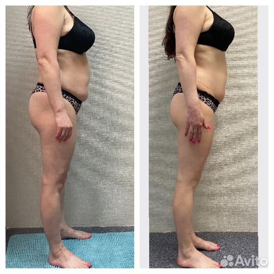 Массаж лица