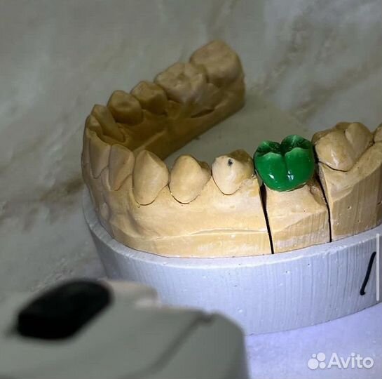 Зубные протезы