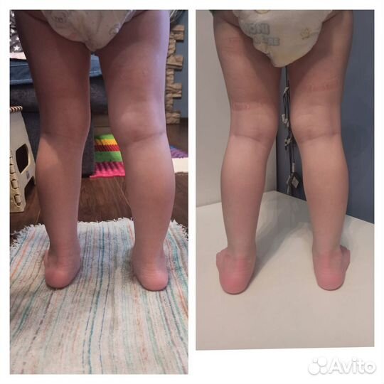 Лечебный массаж, восстановление плсле инсульта