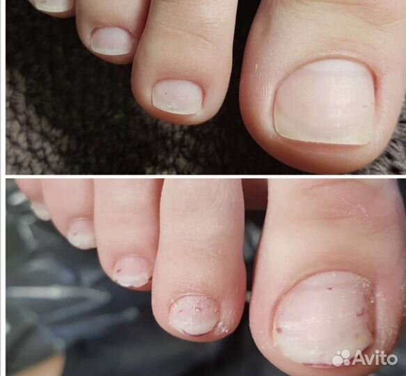 Гигиеническая обработка