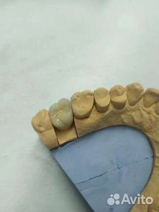 Зубной техник керамист