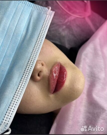 Увеличение губ