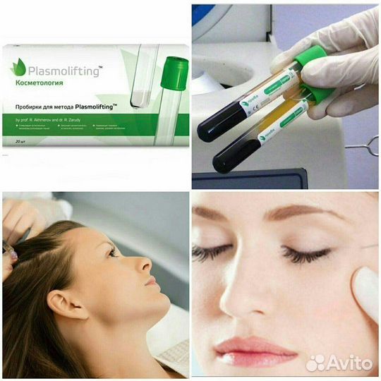 Плазмолифтинг (PRP)