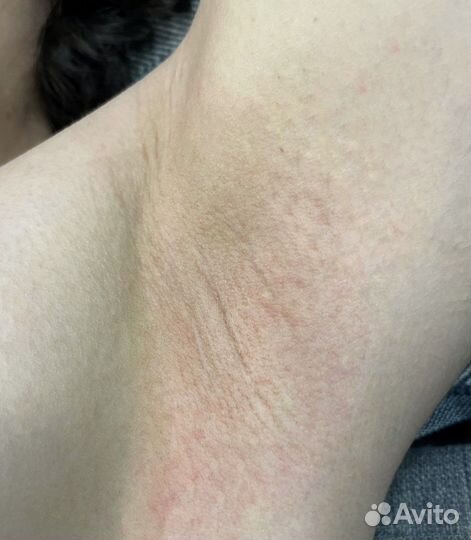 Восковая депиляция